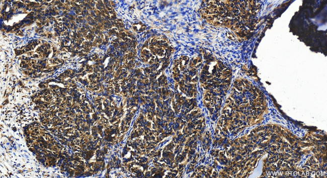 GINS1 Antibody in Immunohistochemistry (Paraffin) (IHC (P))