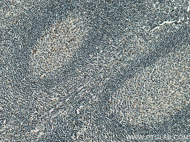 PCIF1 Antibody in Immunohistochemistry (Paraffin) (IHC (P))