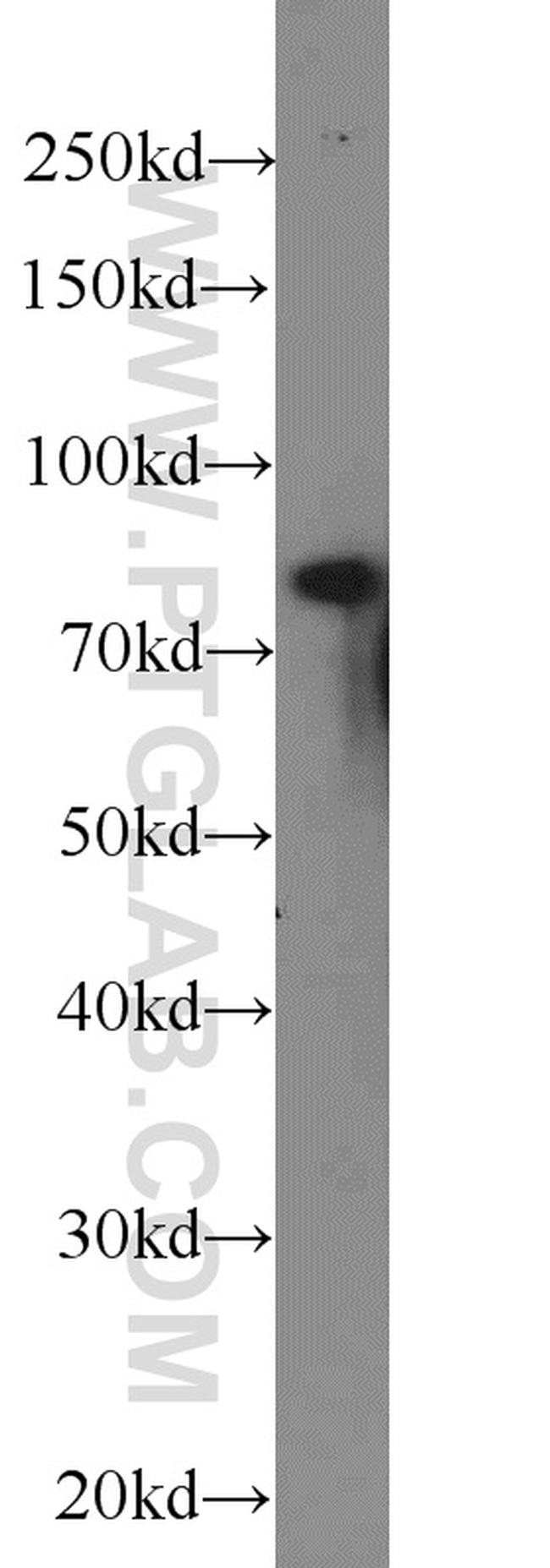 NOL9 Antibody in Western Blot (WB)