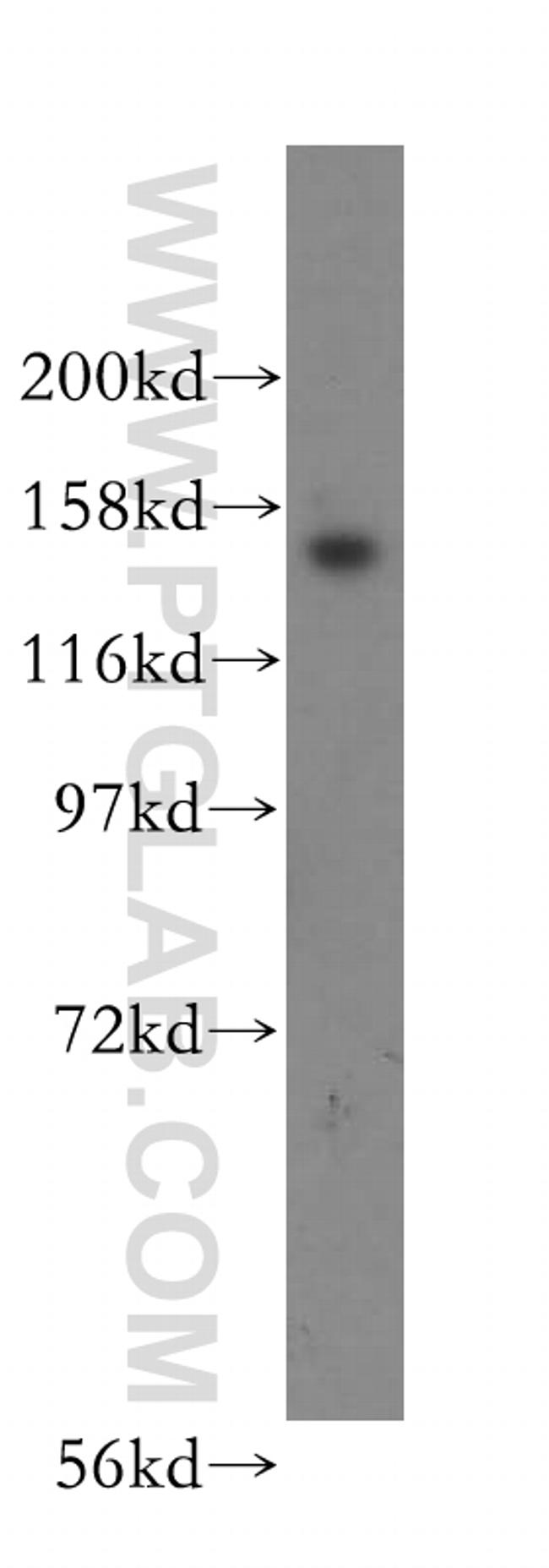 NUP160 Antibody in Western Blot (WB)