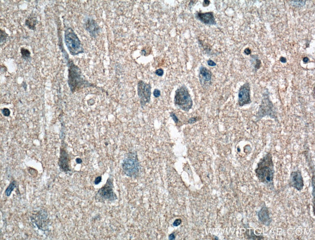 RPL23 Antibody in Immunohistochemistry (Paraffin) (IHC (P))