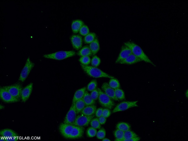 TMEM141 Antibody in Immunocytochemistry (ICC/IF)