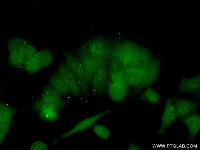 BRMS1 Antibody in Immunocytochemistry (ICC/IF)