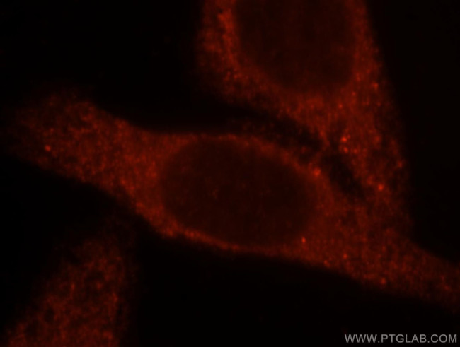 BBOX1 Antibody in Immunocytochemistry (ICC/IF)