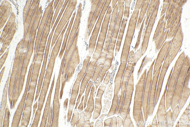 Telethonin Antibody in Immunohistochemistry (Paraffin) (IHC (P))