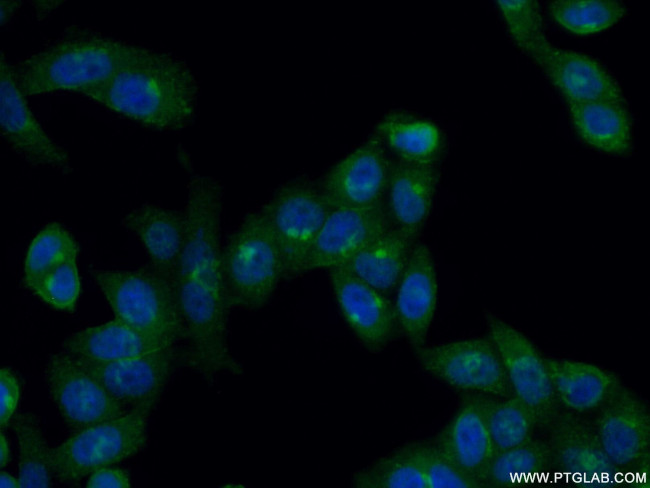 GS28 Antibody in Immunocytochemistry (ICC/IF)