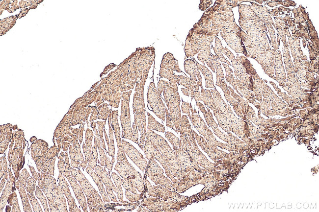 COPG2 Antibody in Immunohistochemistry (Paraffin) (IHC (P))