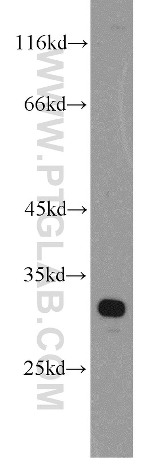 PHYHD1 Antibody in Western Blot (WB)