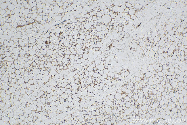 CLMP Antibody in Immunohistochemistry (Paraffin) (IHC (P))