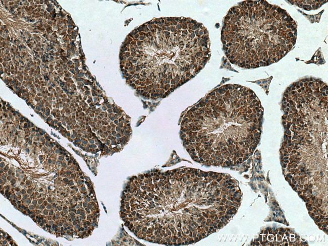 UBXN1 Antibody in Immunohistochemistry (Paraffin) (IHC (P))