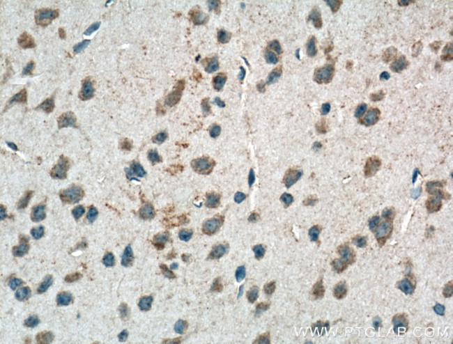 PSENEN Antibody in Immunohistochemistry (Paraffin) (IHC (P))