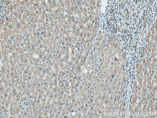 LYPLAL1 Antibody in Immunohistochemistry (Paraffin) (IHC (P))