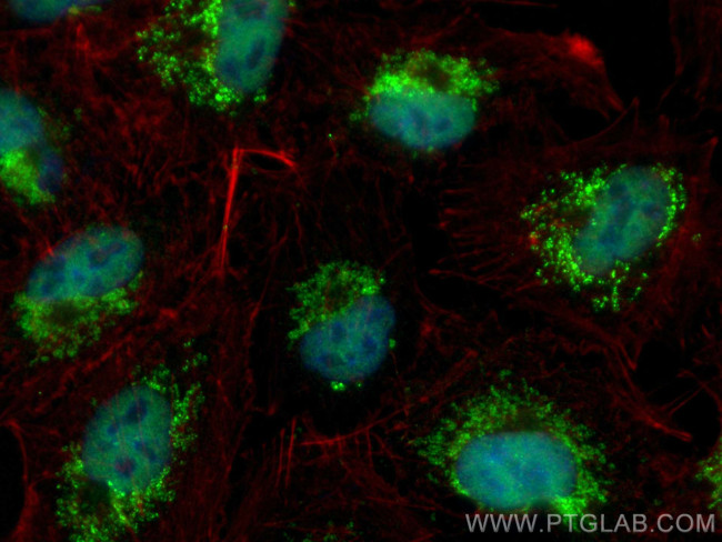 ZMIZ1 Antibody in Immunocytochemistry (ICC/IF)
