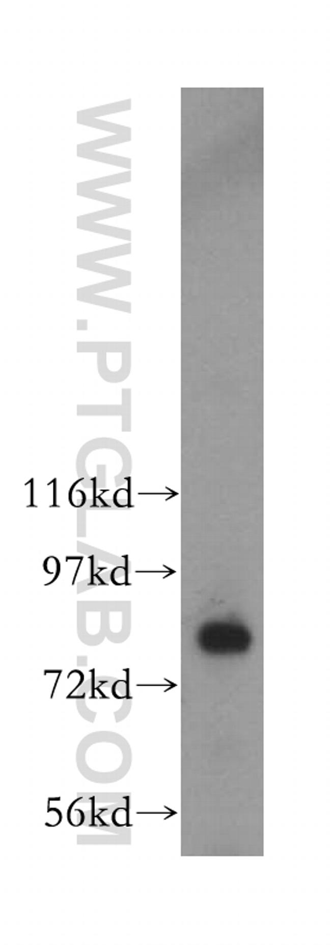MDM1 Antibody in Western Blot (WB)