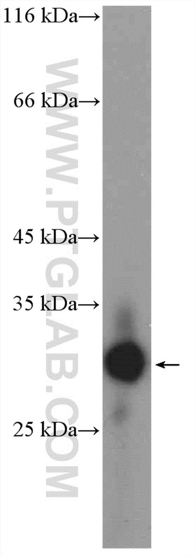 Claudin 9 Antibody in Western Blot (WB)