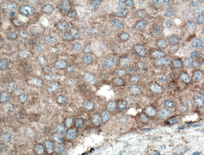 PLEKHM1 Antibody in Immunohistochemistry (Paraffin) (IHC (P))