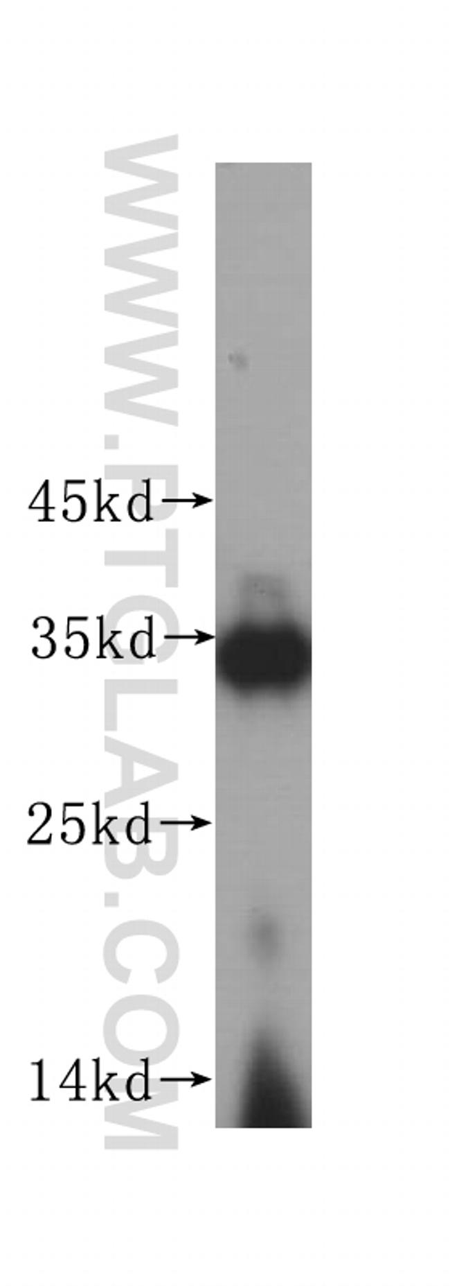 IMP4 Antibody in Western Blot (WB)