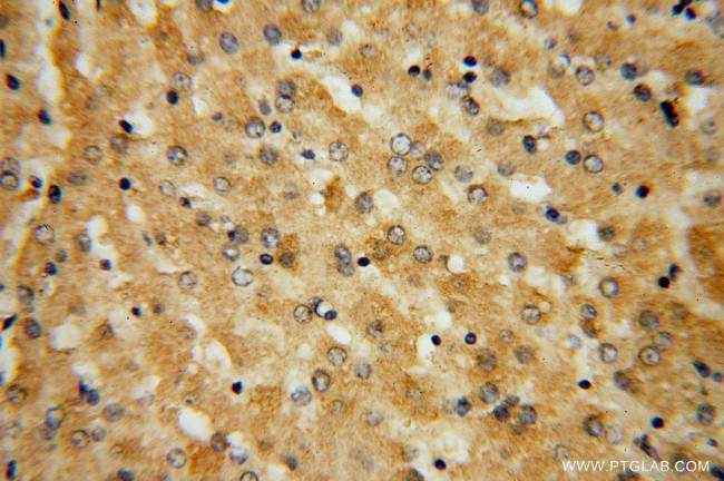 GGCX Antibody in Immunohistochemistry (Paraffin) (IHC (P))