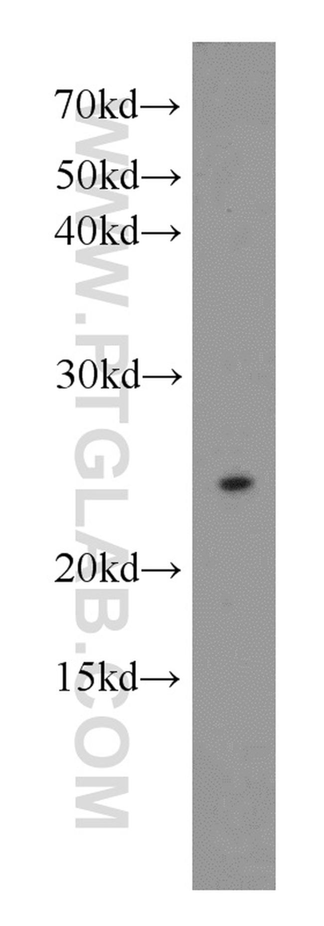 N6AMT1 Antibody in Western Blot (WB)