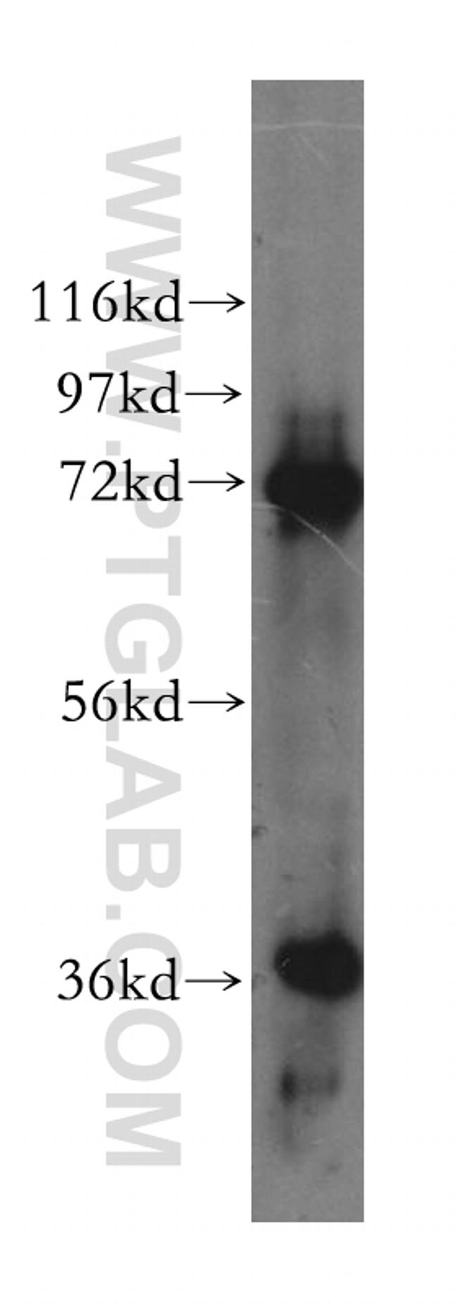 KLHL22 Antibody in Western Blot (WB)