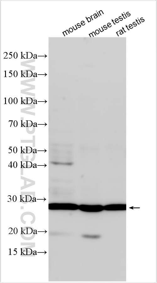 RPL10L Antibody in Western Blot (WB)