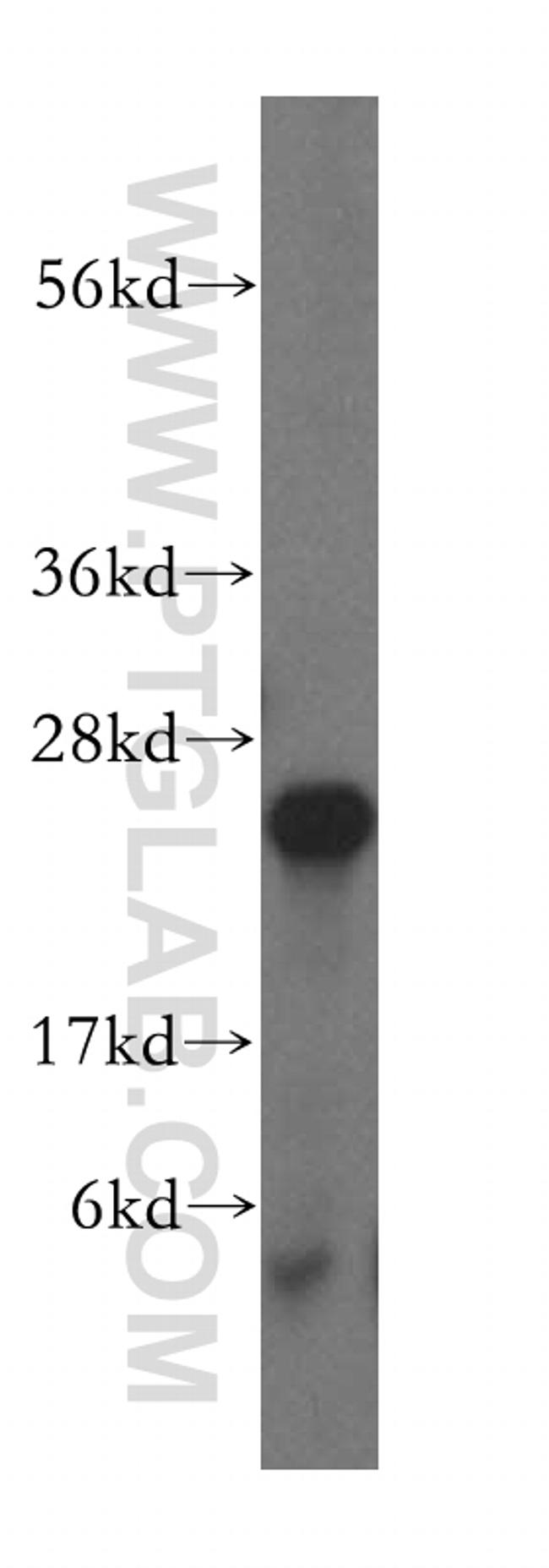 MRPL24 Antibody in Western Blot (WB)