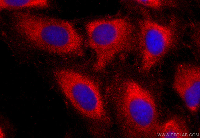 ABI3 Antibody in Immunocytochemistry (ICC/IF)