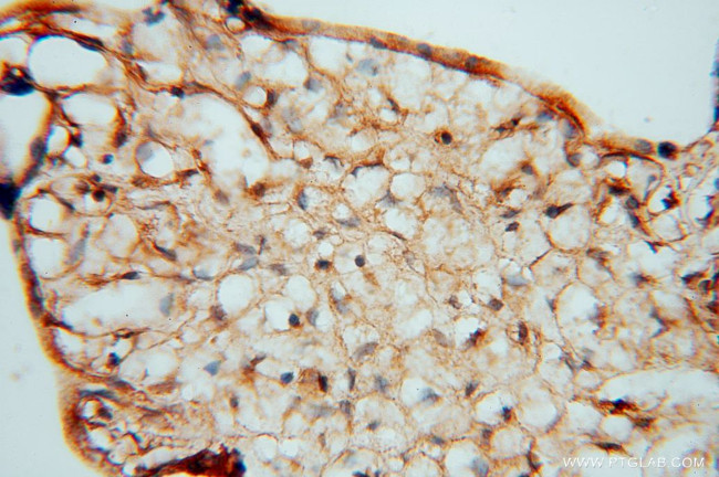 KDSR Antibody in Immunohistochemistry (Paraffin) (IHC (P))