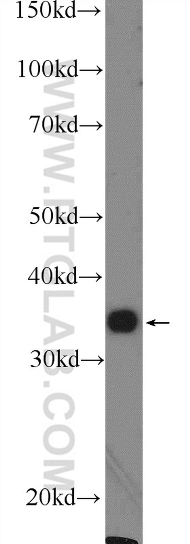 FOXS1 Antibody in Western Blot (WB)