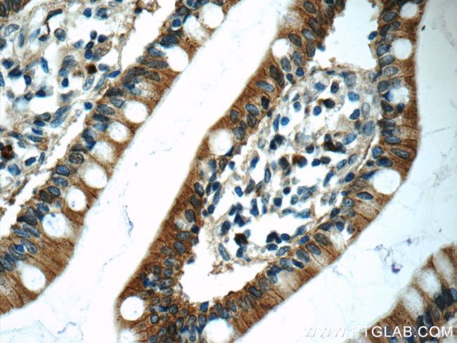 Carboxypeptidase A3 Antibody in Immunohistochemistry (Paraffin) (IHC (P))