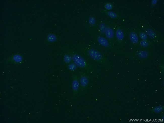 KRI1 Antibody in Immunocytochemistry (ICC/IF)