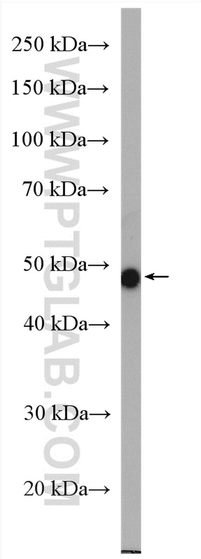 DMKN Antibody in Western Blot (WB)