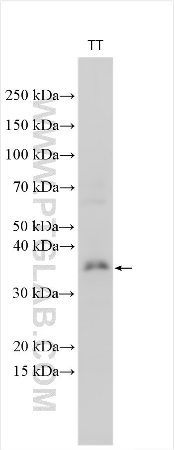 CHMP4C Antibody in Western Blot (WB)