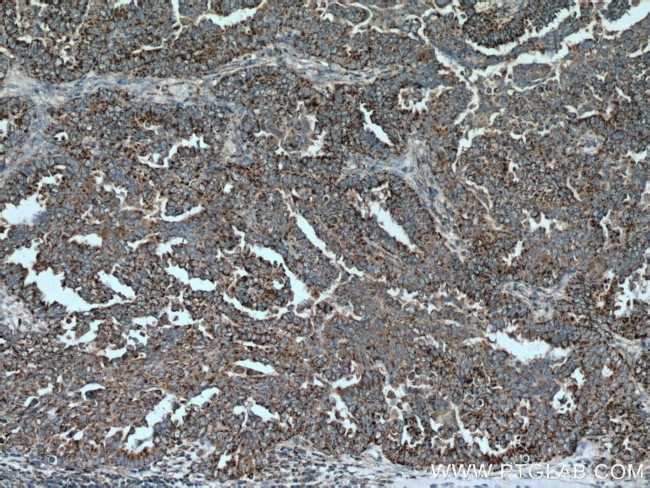 GADD45GIP1 Antibody in Immunohistochemistry (Paraffin) (IHC (P))