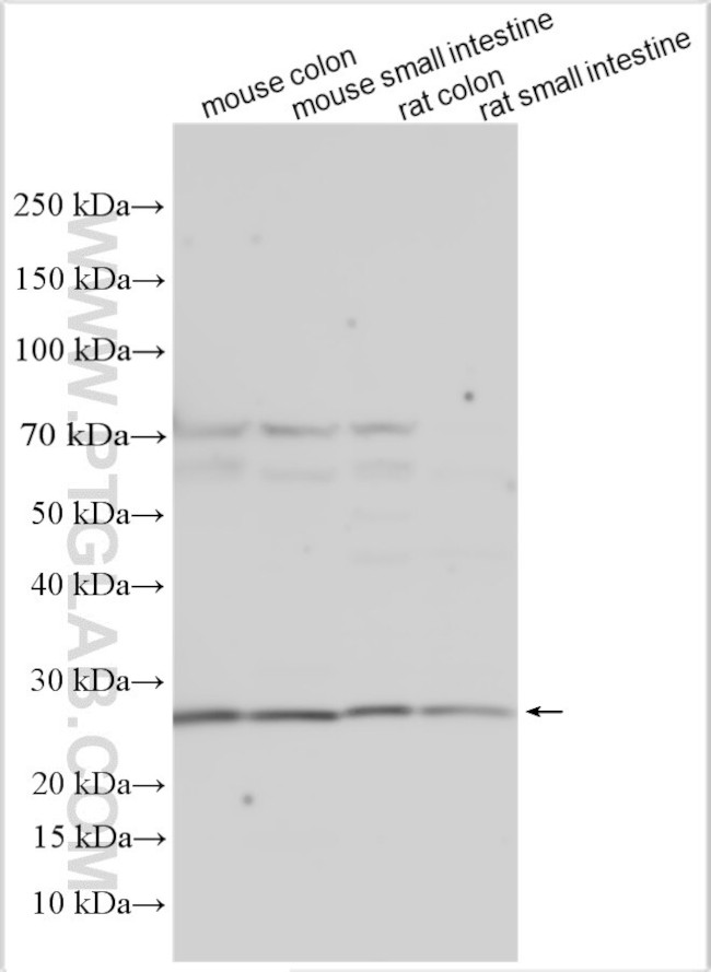 HTN3 Antibody in Western Blot (WB)