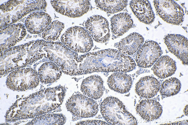 MED28 Antibody in Immunohistochemistry (Paraffin) (IHC (P))