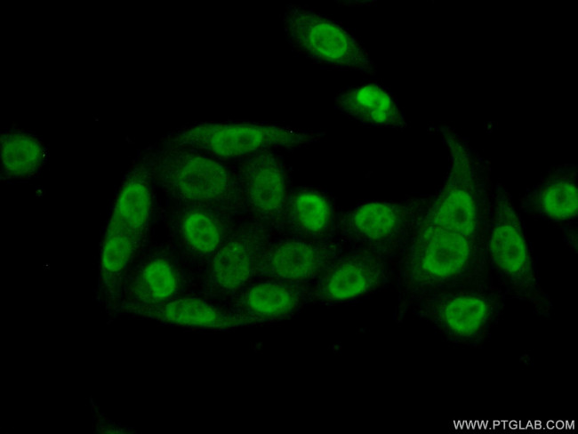 PQBP1 Antibody in Immunocytochemistry (ICC/IF)