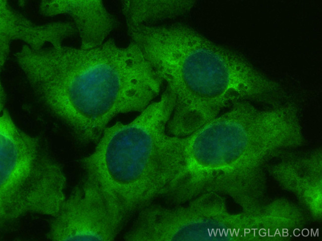 RPS17 Antibody in Immunocytochemistry (ICC/IF)