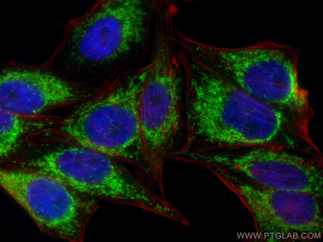 MRPS6 Antibody in Immunocytochemistry (ICC/IF)