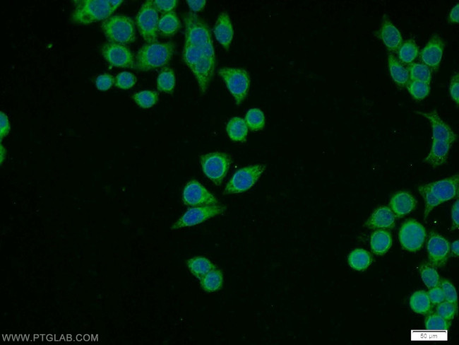 RPL11 Antibody in Immunocytochemistry (ICC/IF)