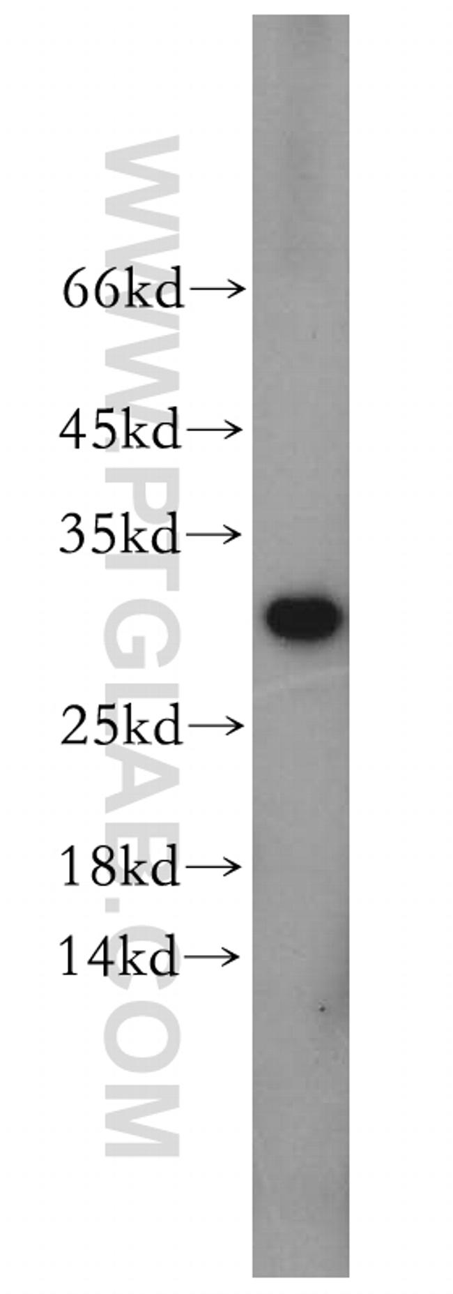CHMP6 Antibody in Western Blot (WB)