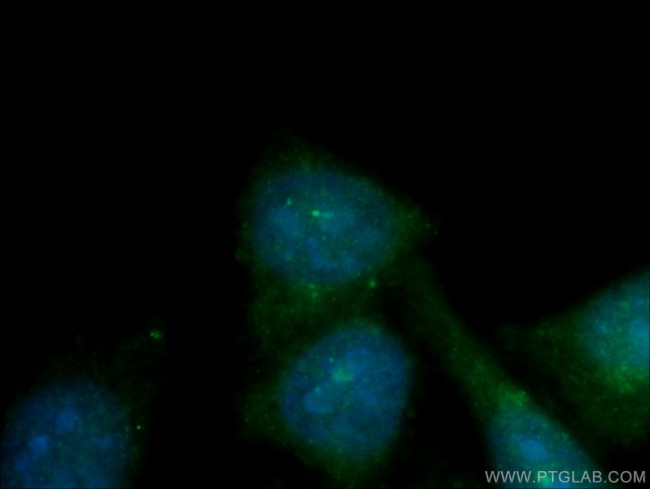 CEP70 Antibody in Immunocytochemistry (ICC/IF)