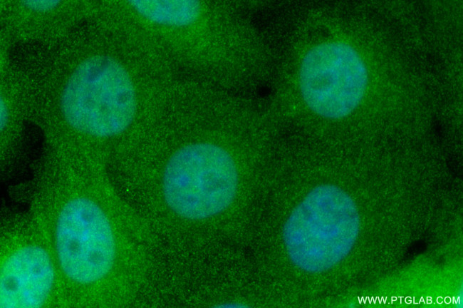 HN1L Antibody in Immunocytochemistry (ICC/IF)