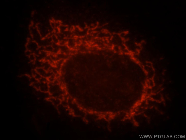 MRPS31 Antibody in Immunocytochemistry (ICC/IF)