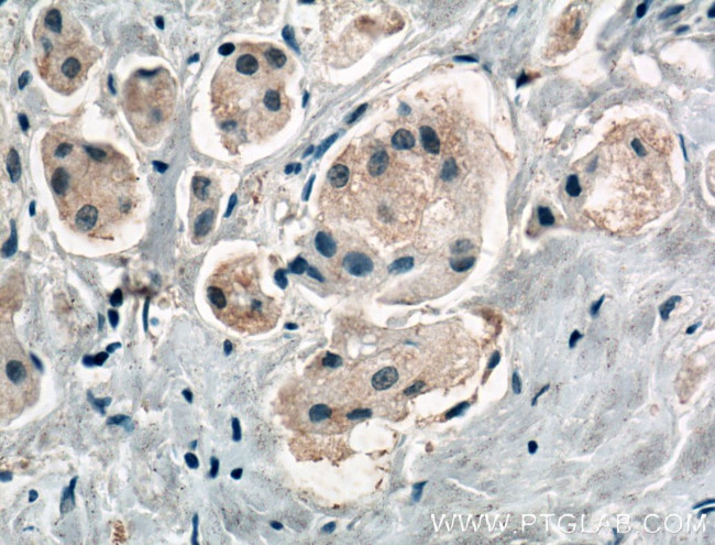 HOIP Antibody in Immunohistochemistry (Paraffin) (IHC (P))