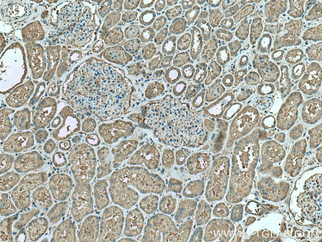 CDC37L1 Antibody in Immunohistochemistry (Paraffin) (IHC (P))