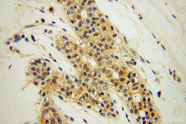 SPAG7 Antibody in Immunohistochemistry (Paraffin) (IHC (P))