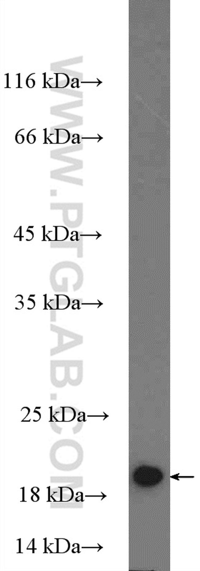 MRPL22 Antibody in Western Blot (WB)