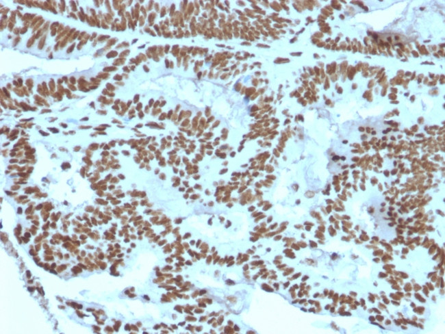 Zinc Finger Protein 846/ZNF846 Antibody in Immunohistochemistry (Paraffin) (IHC (P))