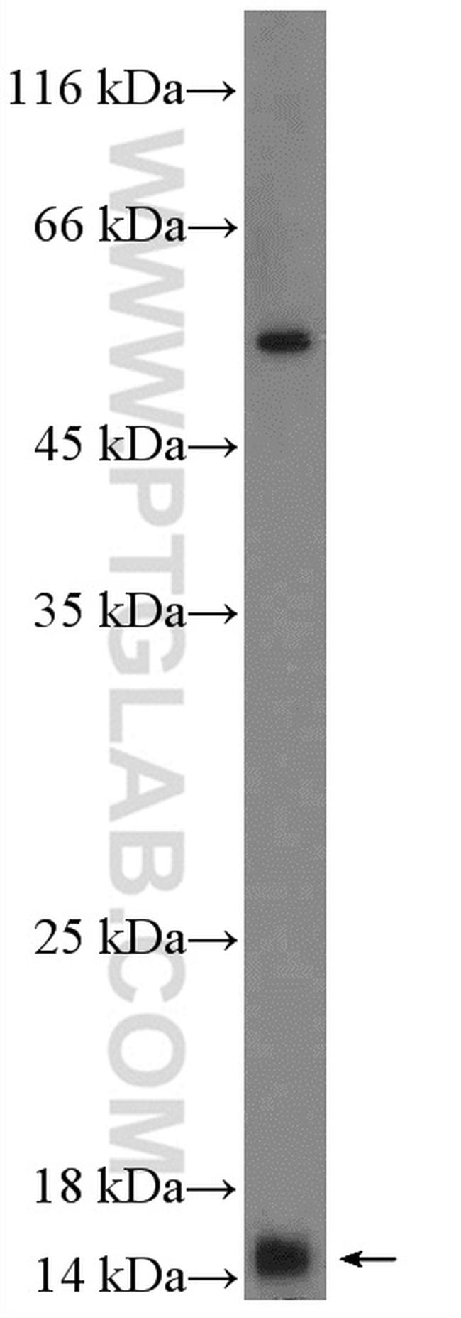 MRPS14 Antibody in Western Blot (WB)